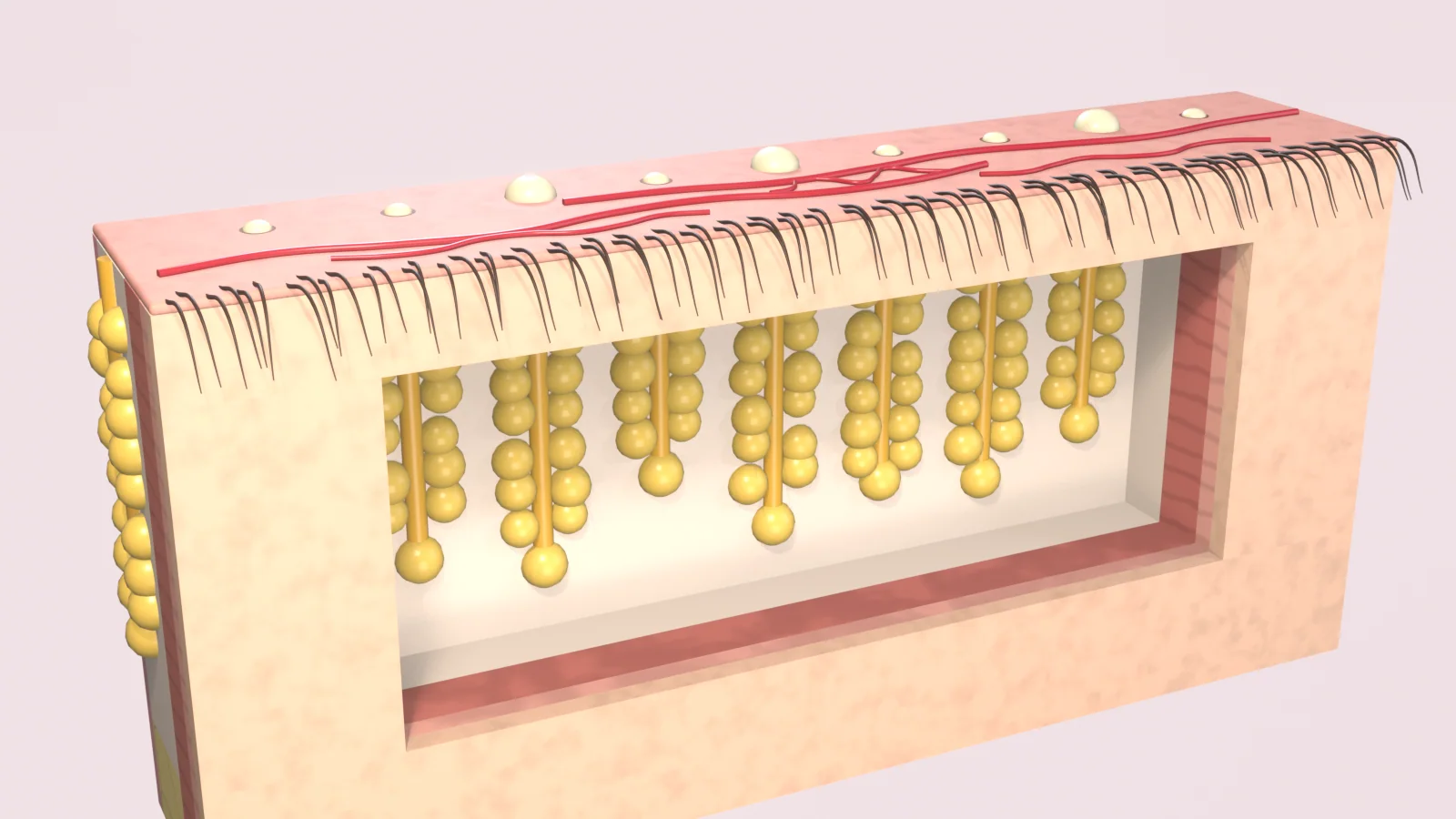 Lower eyelid cut open to show its row of yellow oil glands, with plugged gland openings, fine red vessels and lashes along the lid margin